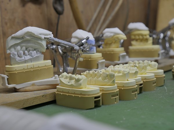 歯科技工士 銀歯1個の製作費400円、連日20時間の過酷労働｜NEWSポスト